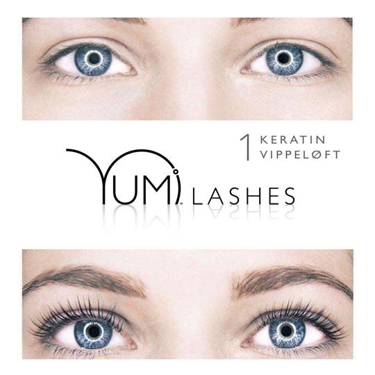 Yumilashes behandling, before-after.